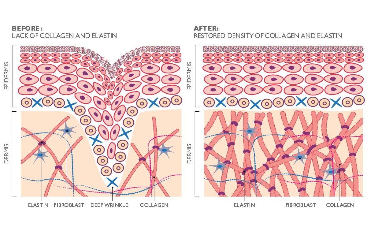 Silk'n Antiaging-Gerät FaceTite Revive Cordless Weiss