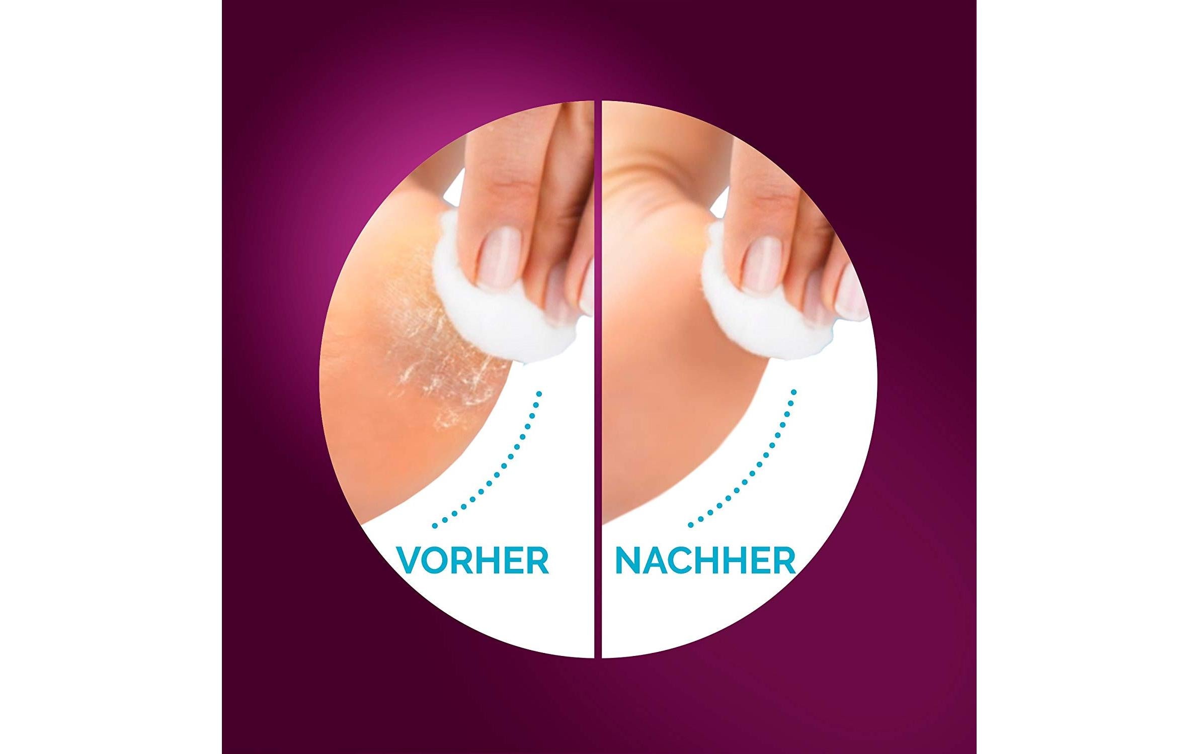 Scholl Hornhautentferner Velvet Smooth Wet & Dry