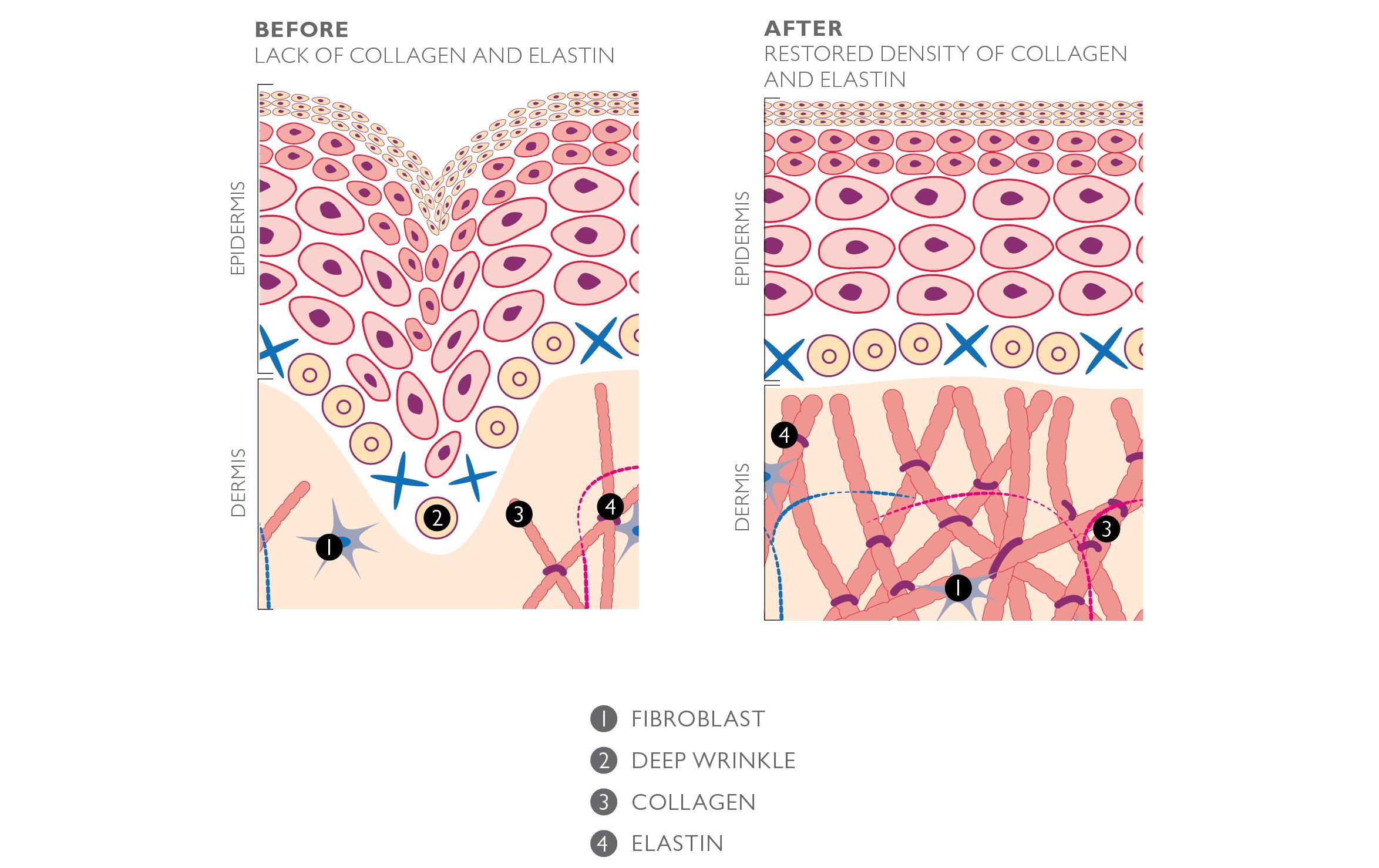 Silk'n Antiaging-Gerät FaceTite Mini